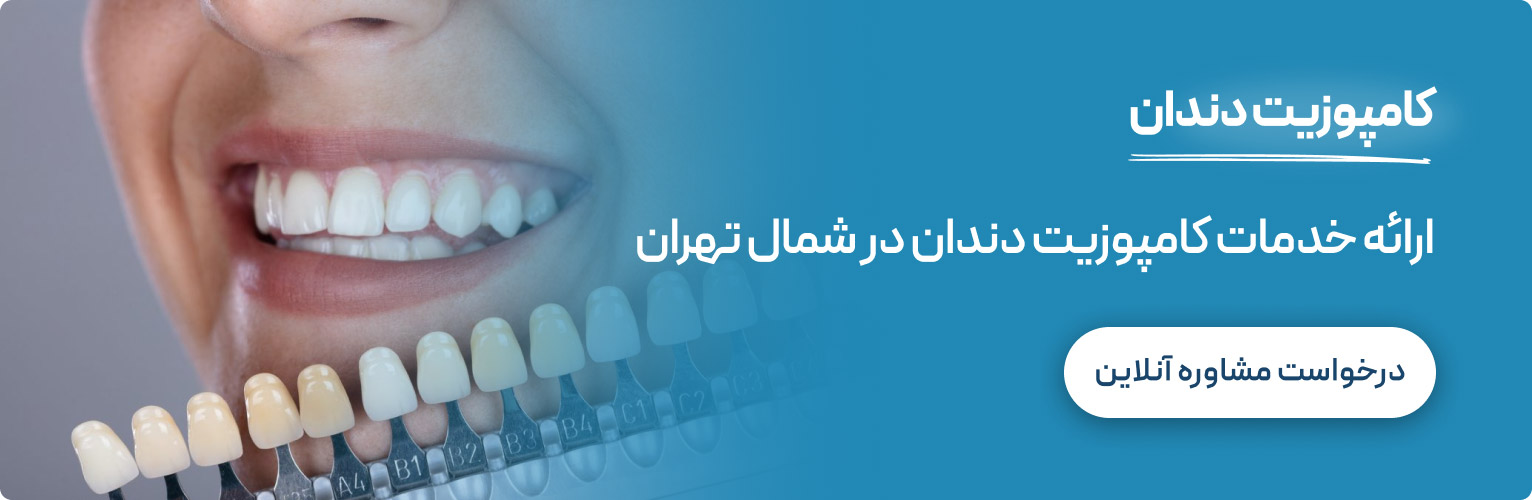 خدمات کامپوزیت دندان