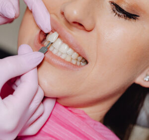 ونیر دندان پزشکی