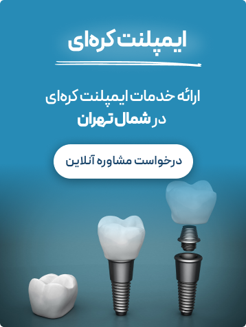 ایمپلنت کره ای